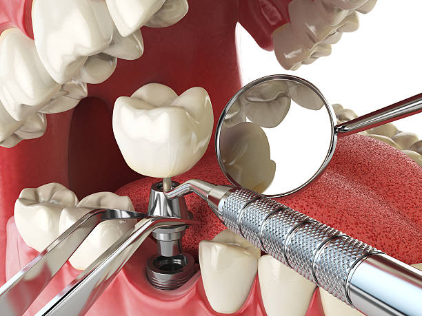 Best Dentist for Severe Toothache  in Big River, CA